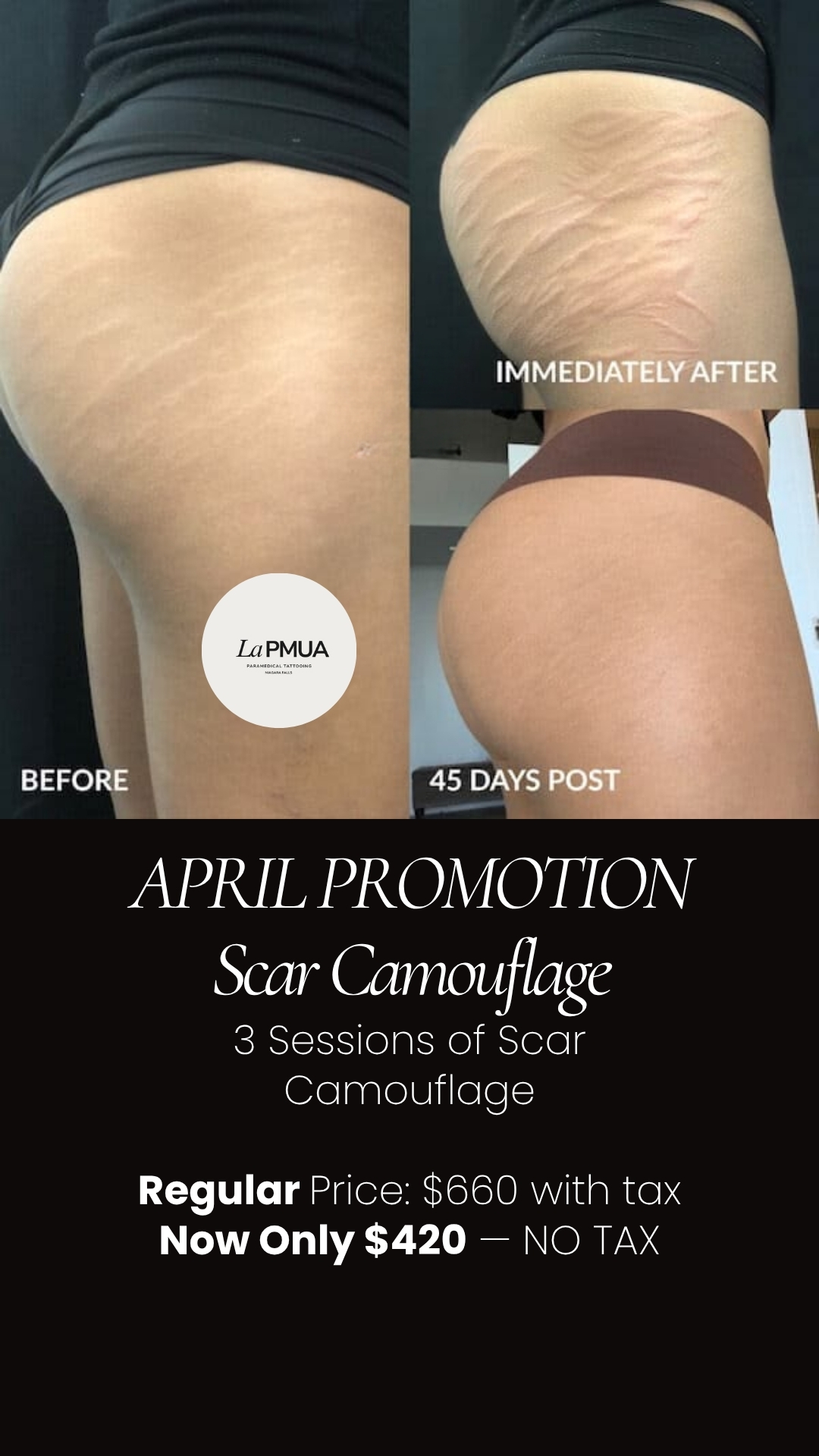 Inkless Scar Revision Before and After